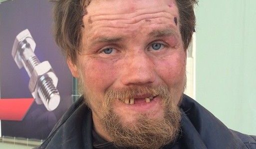 Что происходит с мозгом при употреблении наркотиков и алкоголя